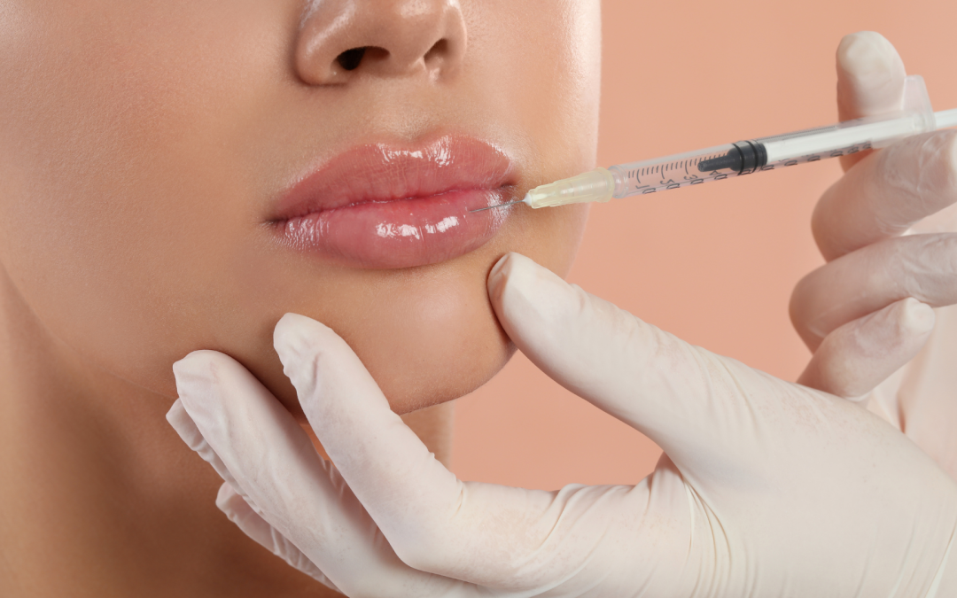 5 Tipps zu Kosmetika und Behandlungsmöglichkeiten für natürlich schöne Lippen