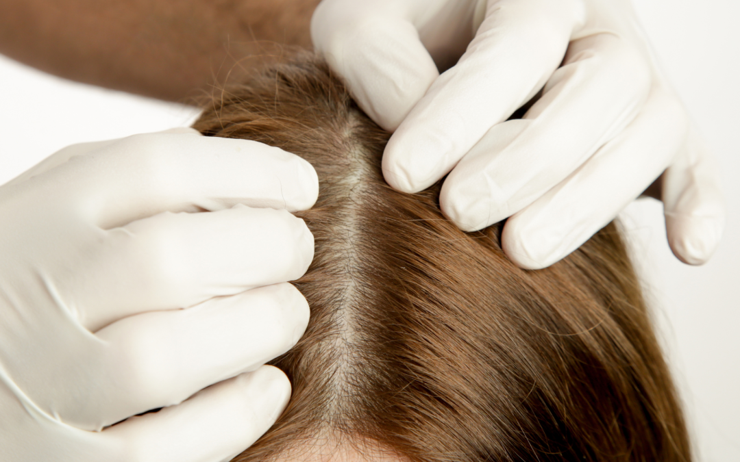 HYDRAFACIAL™ KERAVIVE™  – Eine gesunde Kopfhaut für gesundes Haar